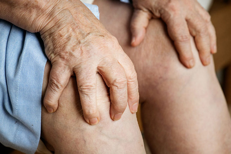 síntomas de la Artritis Reumatoide